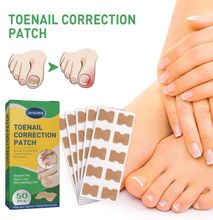 Jaysuing 50pcs/Box Ingrown Toenail Sticker Toenail Correction Patch Tools Kit Nail Foot Tool Toe Nail Fingernail Care Tool